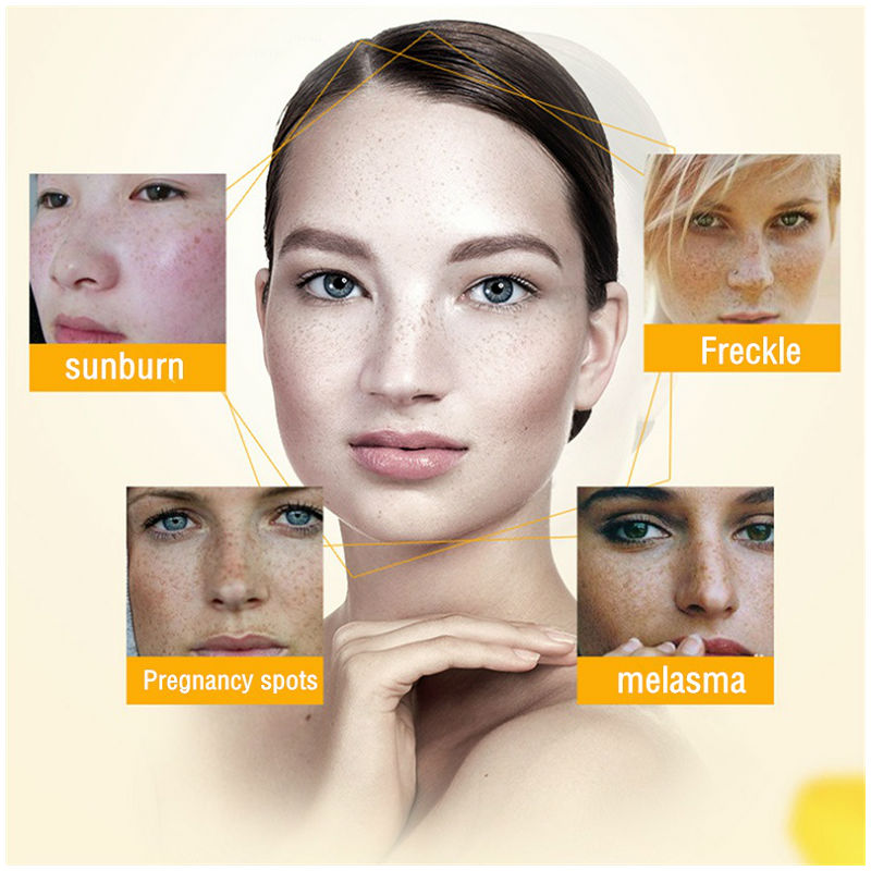 Dimollaure Whitening Sproet Cr - Skincare Korea recensie en prijs