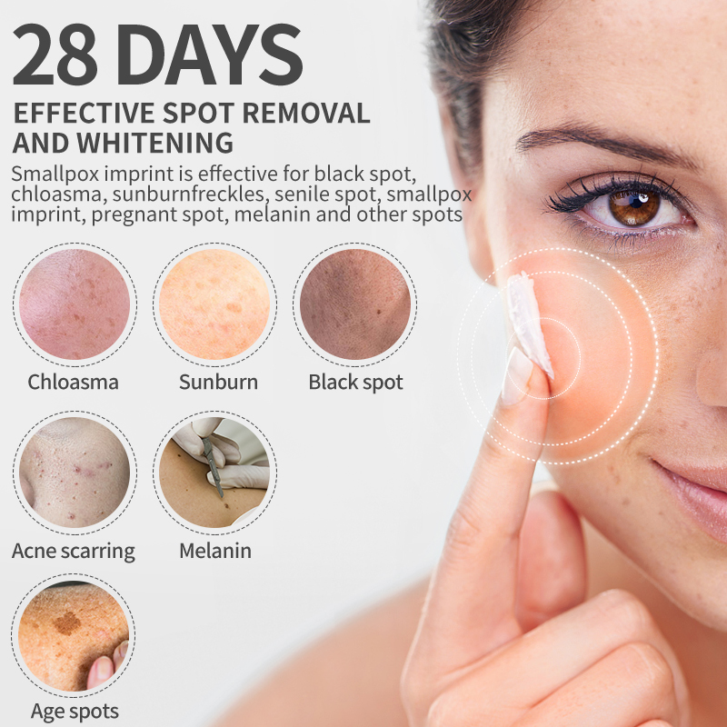 Dimollaure Whitening Sproet Cr - Skincare Korea recensie en prijs