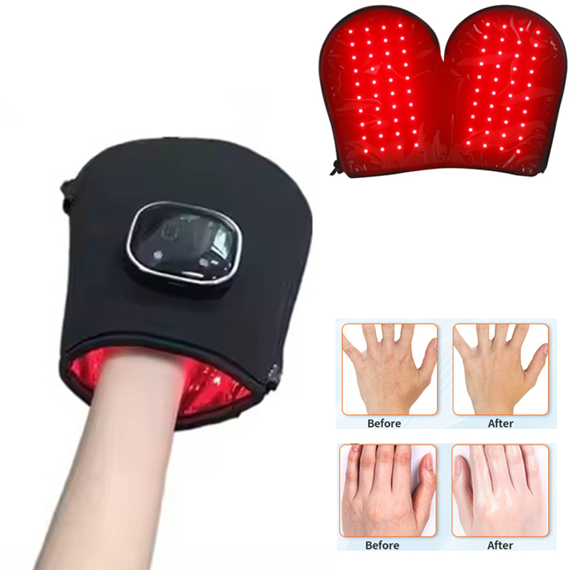 Nieuw Rood Lichttherapie Appar - Skincare Glowing recensie en prijs